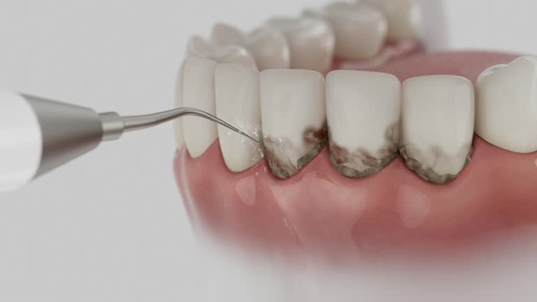 Reliable Dental Implants contractor in Bethany, OK by Smile Center Dentistry